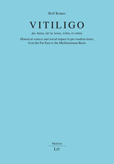 Vitiligo